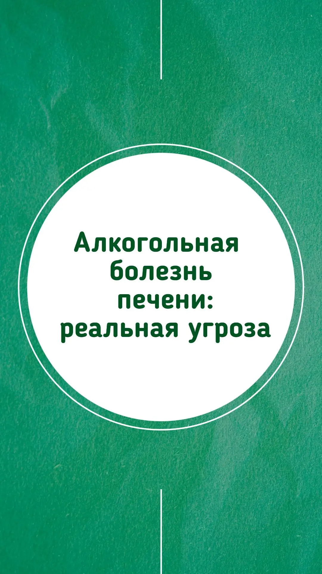 🫙 Алкогольная болезнь печени: реальная угроза

Печень — один из главных «фильтров» организма: она о