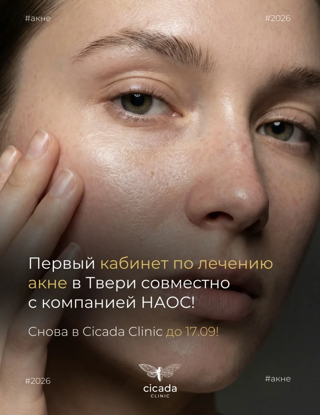 Снова запускаем «Кабинет акне» совместно с компанией НАОС. -50% от стоимости вашего при...