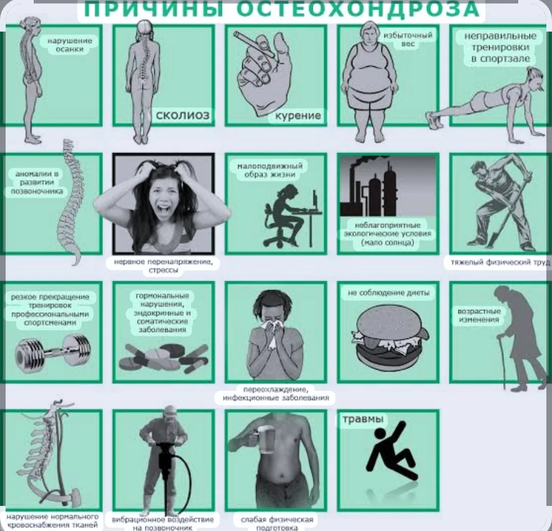 Остеохондроз