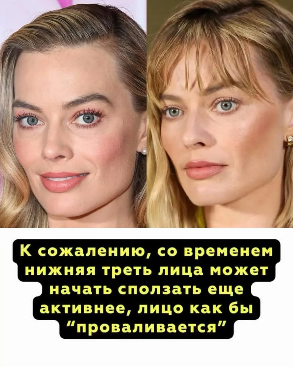 Сейчас все гонятся за острыми скулами и утончённым лицом, и многим кажется, что единственный путь - 