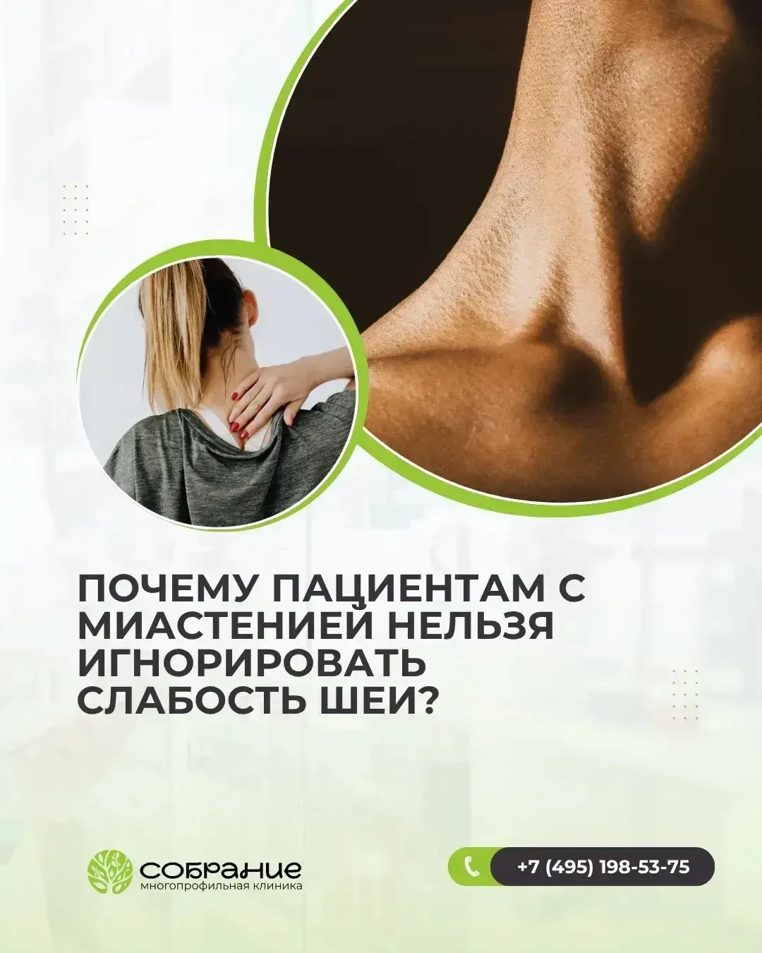 Почему пациентам с миастенией нельзя игнорировать слабость шеи🚨