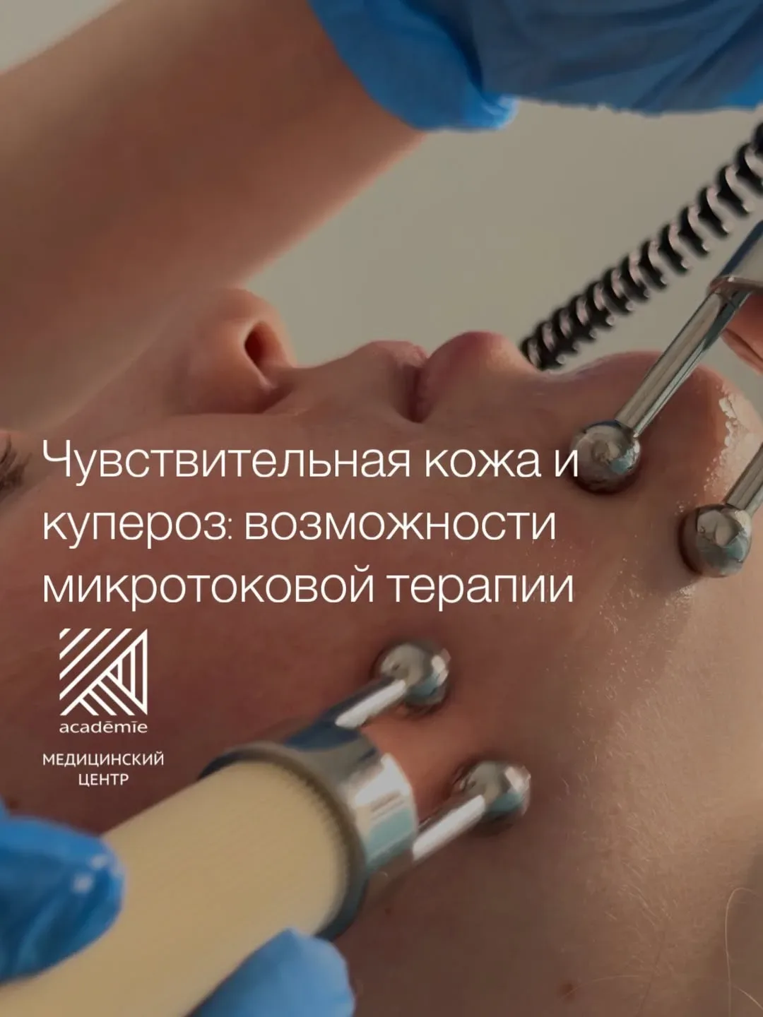 Кожа с признаками купероза требует особенно деликатного подхода. Повышенная чувствитель...