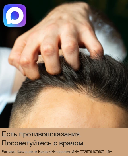 Канал о пересадке волос