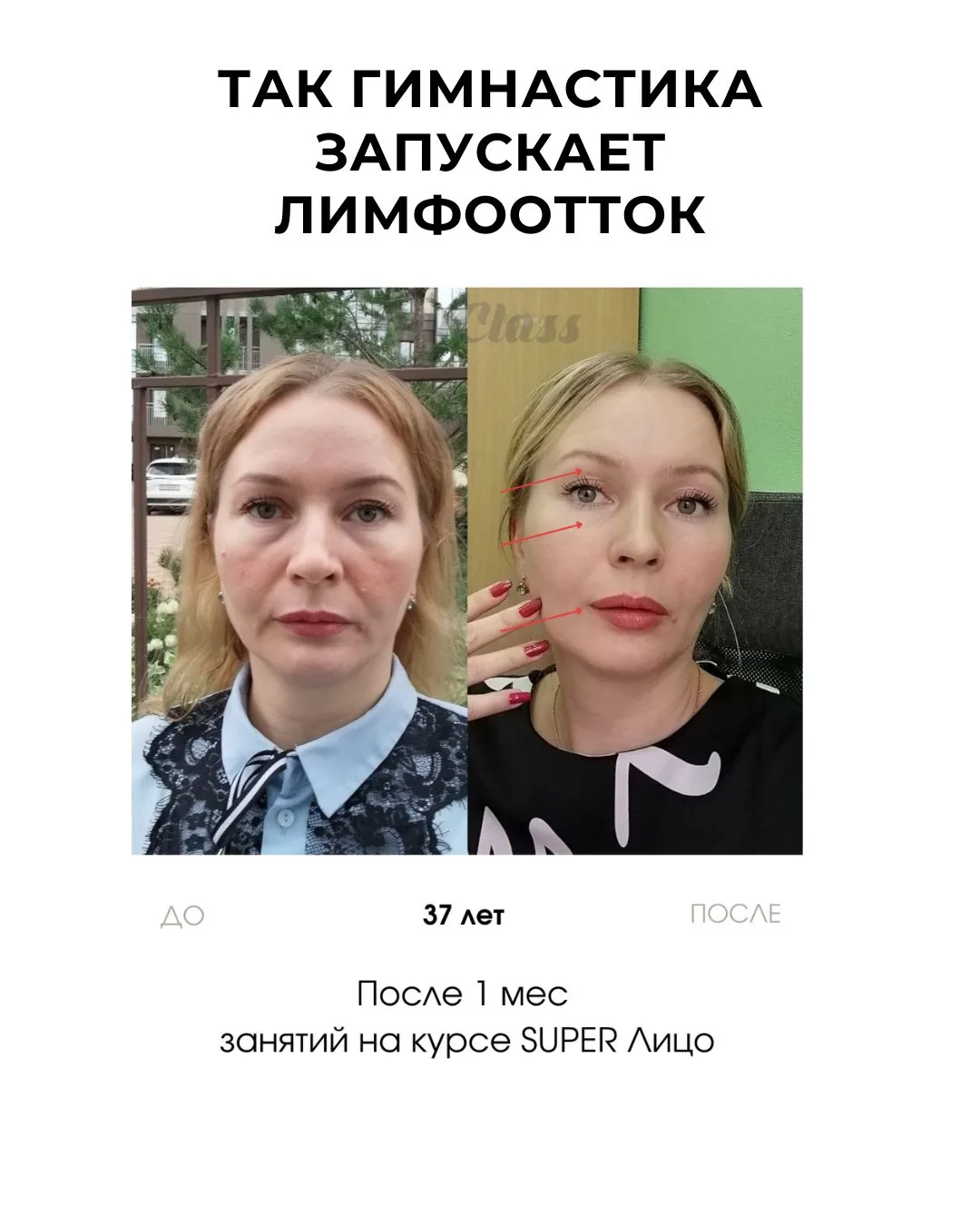 Изображение 3 к публикации «Гимнастика для лица»
