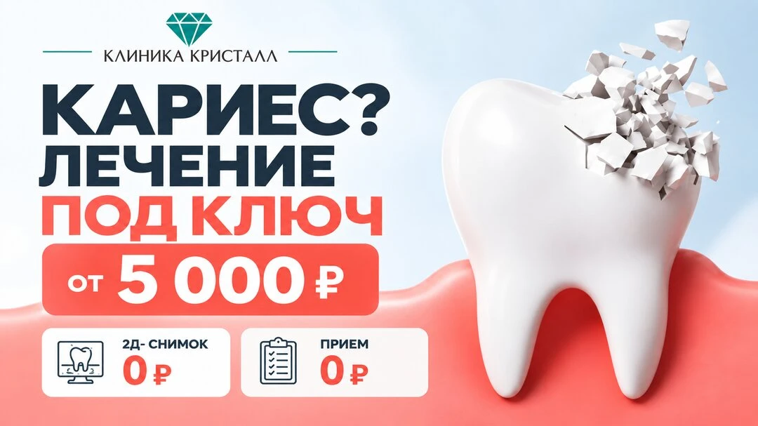 Лечение кариеса под ключ — от 5 000 ₽