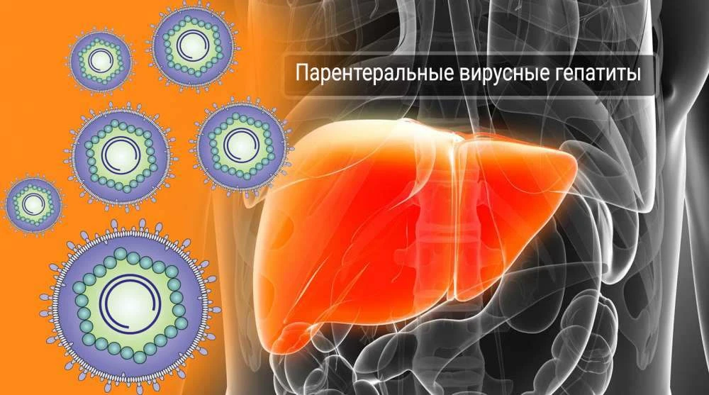 Парентеральные гепатиты: пути передачи, профилактика