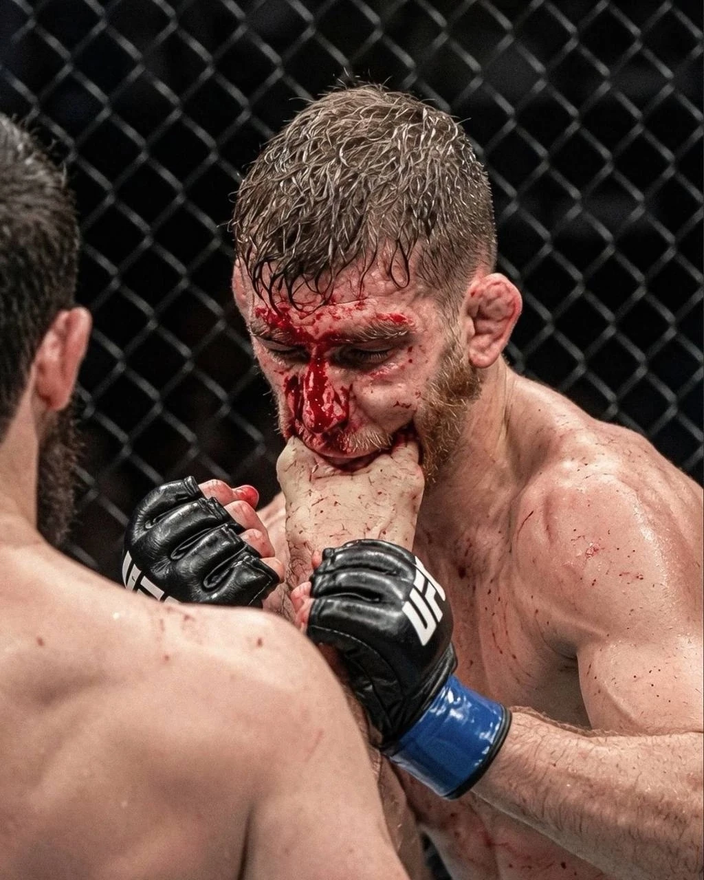 💀🩸 Чанко буквально накормил киками своего соперника

📸 Самое эпичное фото вчерашнего турнира в Аб