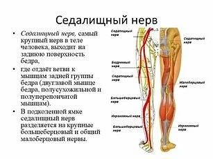 Защемление седалищного нерва, другими словами «ишиас» — это состояние, при котором нерв...