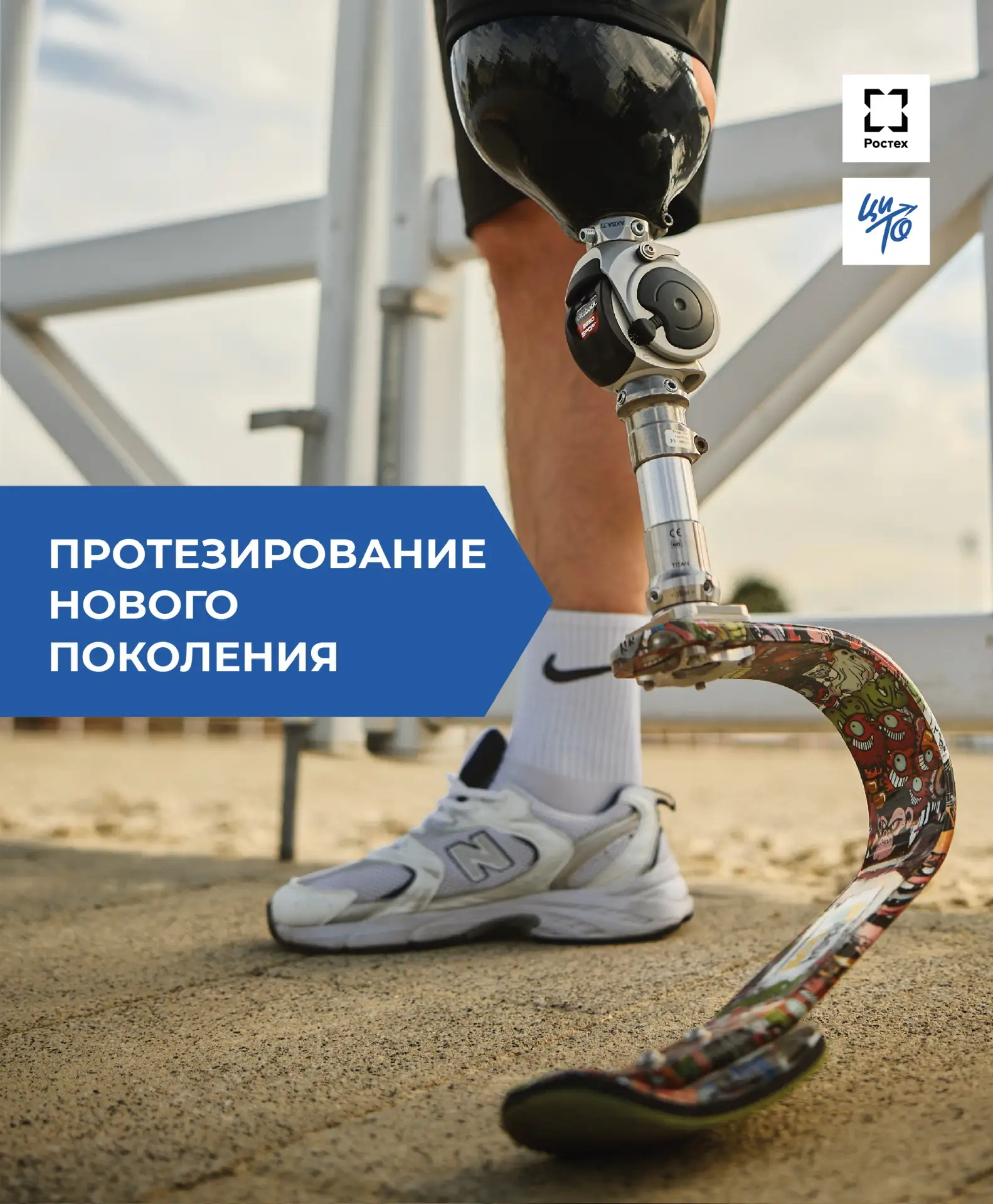 Протезирование нового поколения: концепция будущего уже сегодня