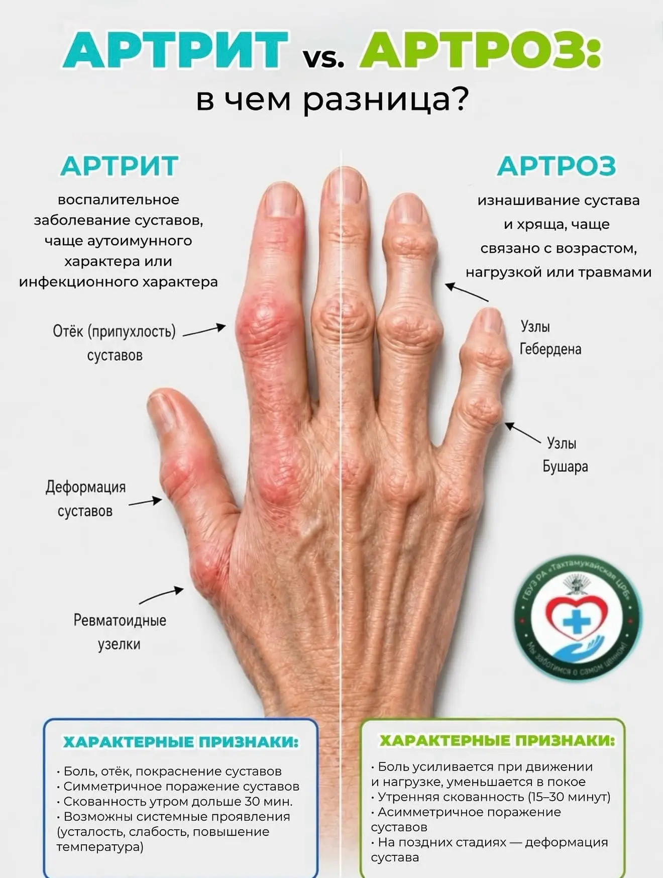 🤚🏼Болит сустав: артрит или артроз?