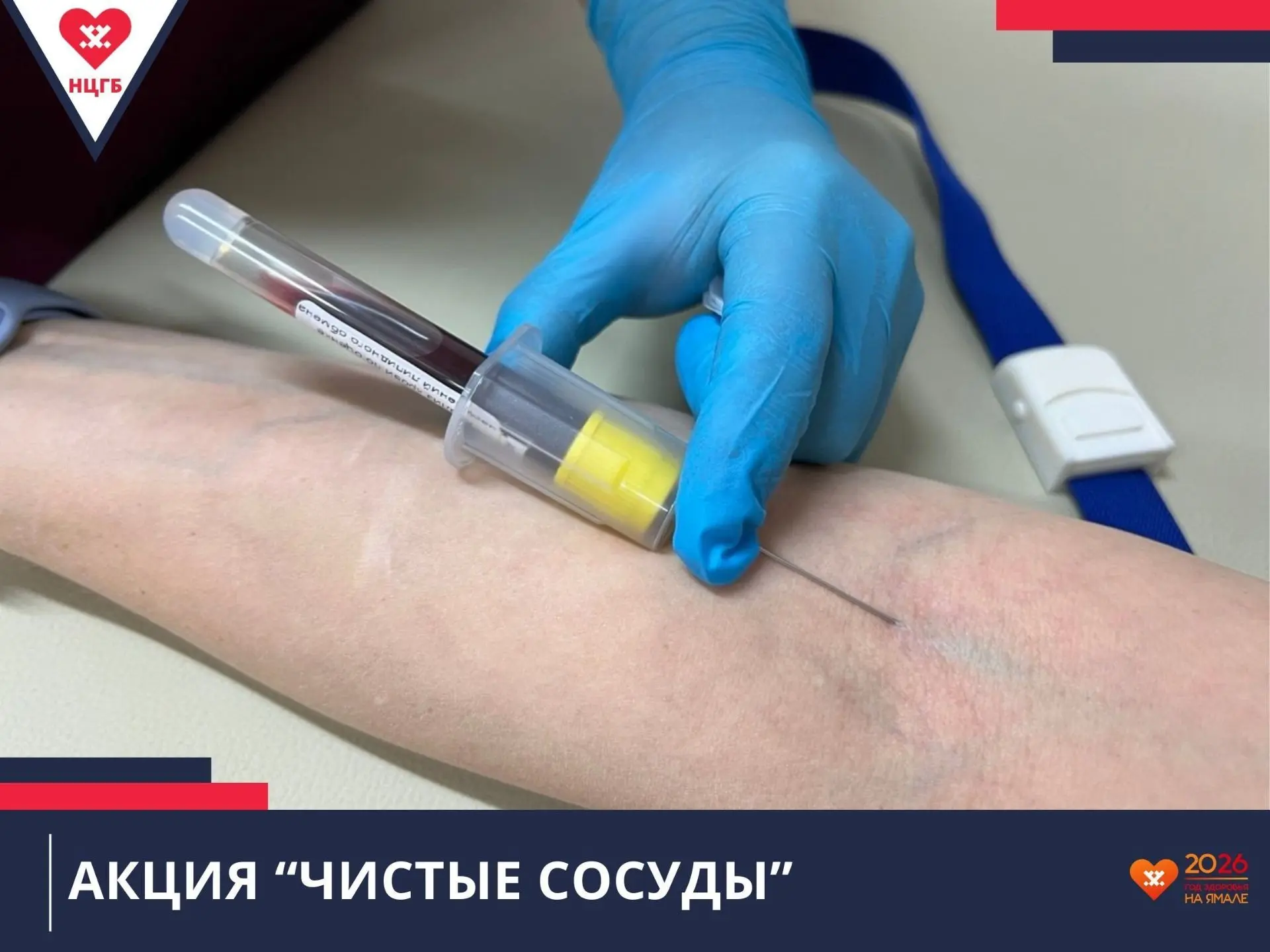 Приглашаем на холестериновый чекап

🔻Проверим уровень холестерина различных фракций, выявим нарушен
