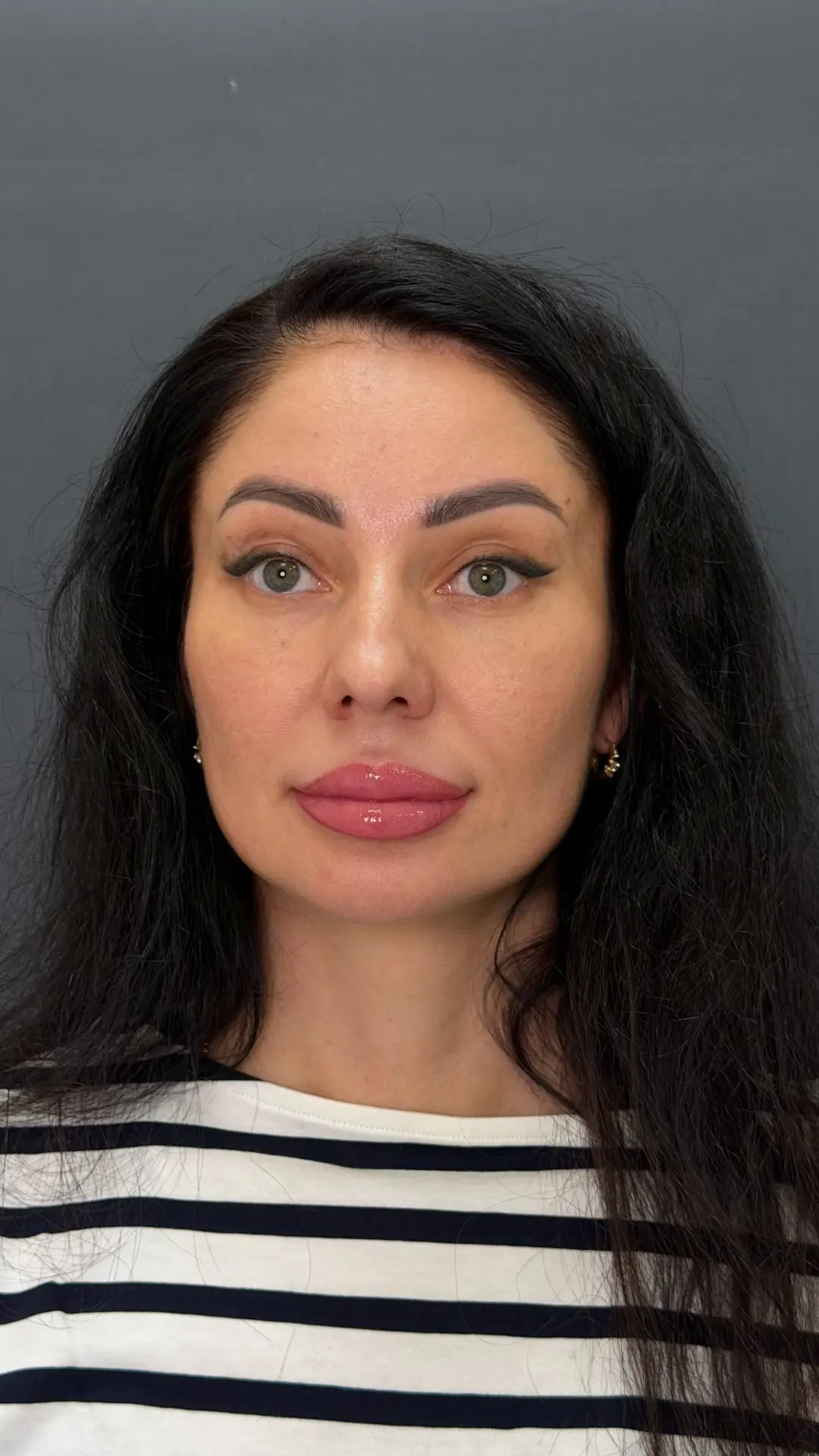 Когда пациент переступает порог 40-летия, она часто замечает, что привычный уход перест...