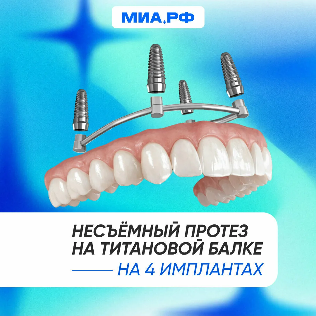 Все зубы за 1 день с несъёмным протезом от 91 000 ₽  Держим цены прошлого года!   Анестезия, расходн