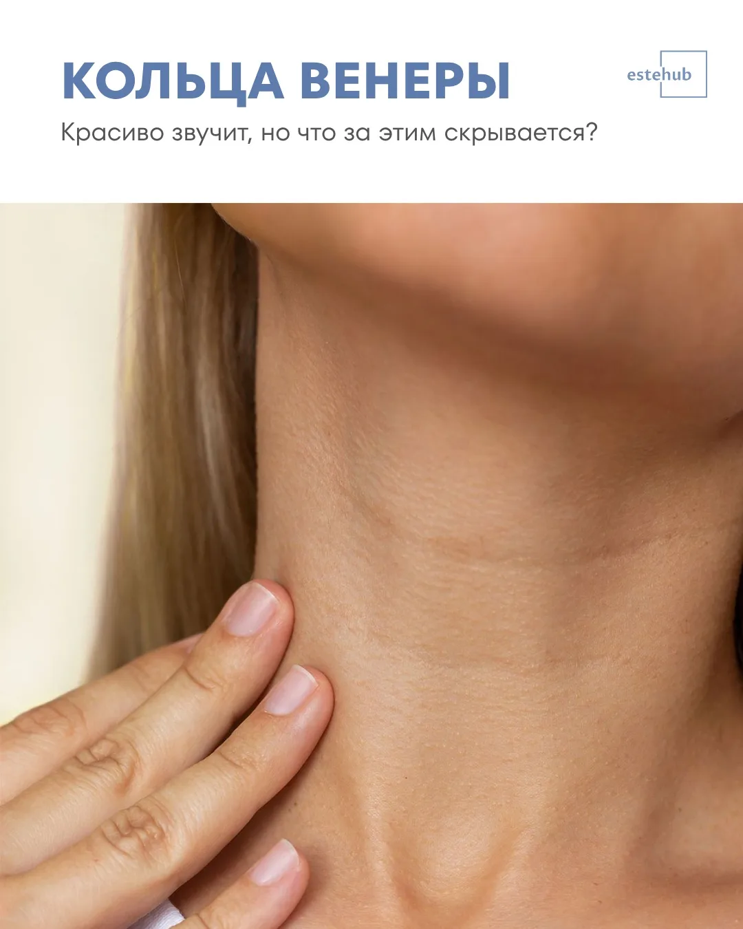 💫Кольца Венеры — звучит красиво, но мало кто рад их появлению на шее.
