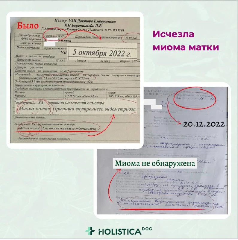 Ранний климакс и печень: что показывают последние исследования  Сейчас появляется всё больше данных,