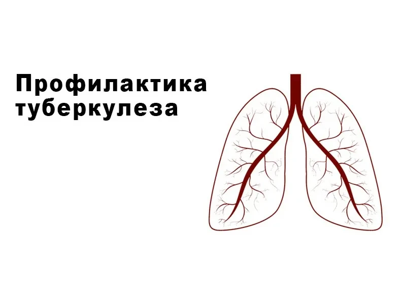 Профилактика туберкулеза строится на трех уровнях: защита детей через вакцинацию, ранне...