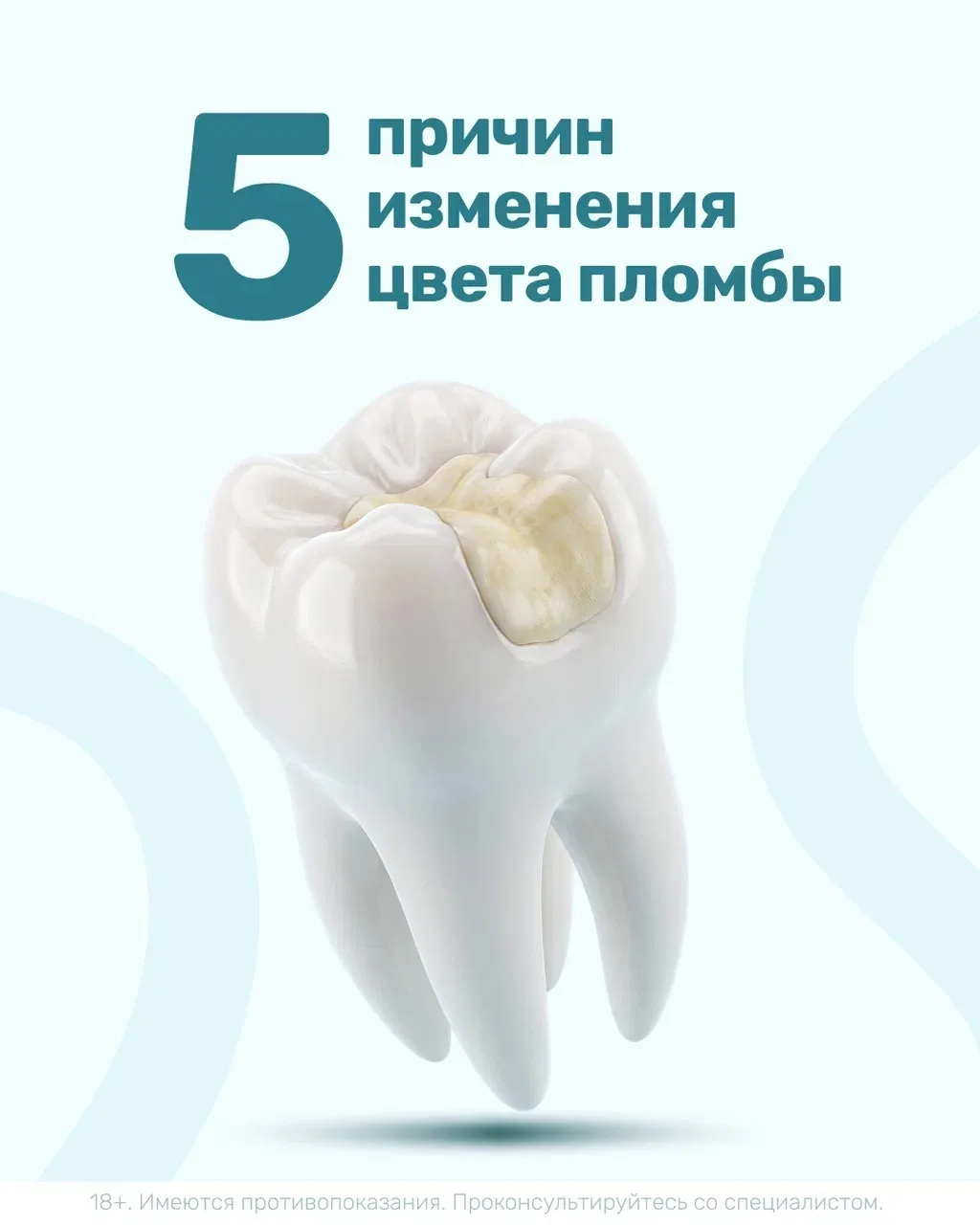 🤔 Почему пломба может изменить цвет?