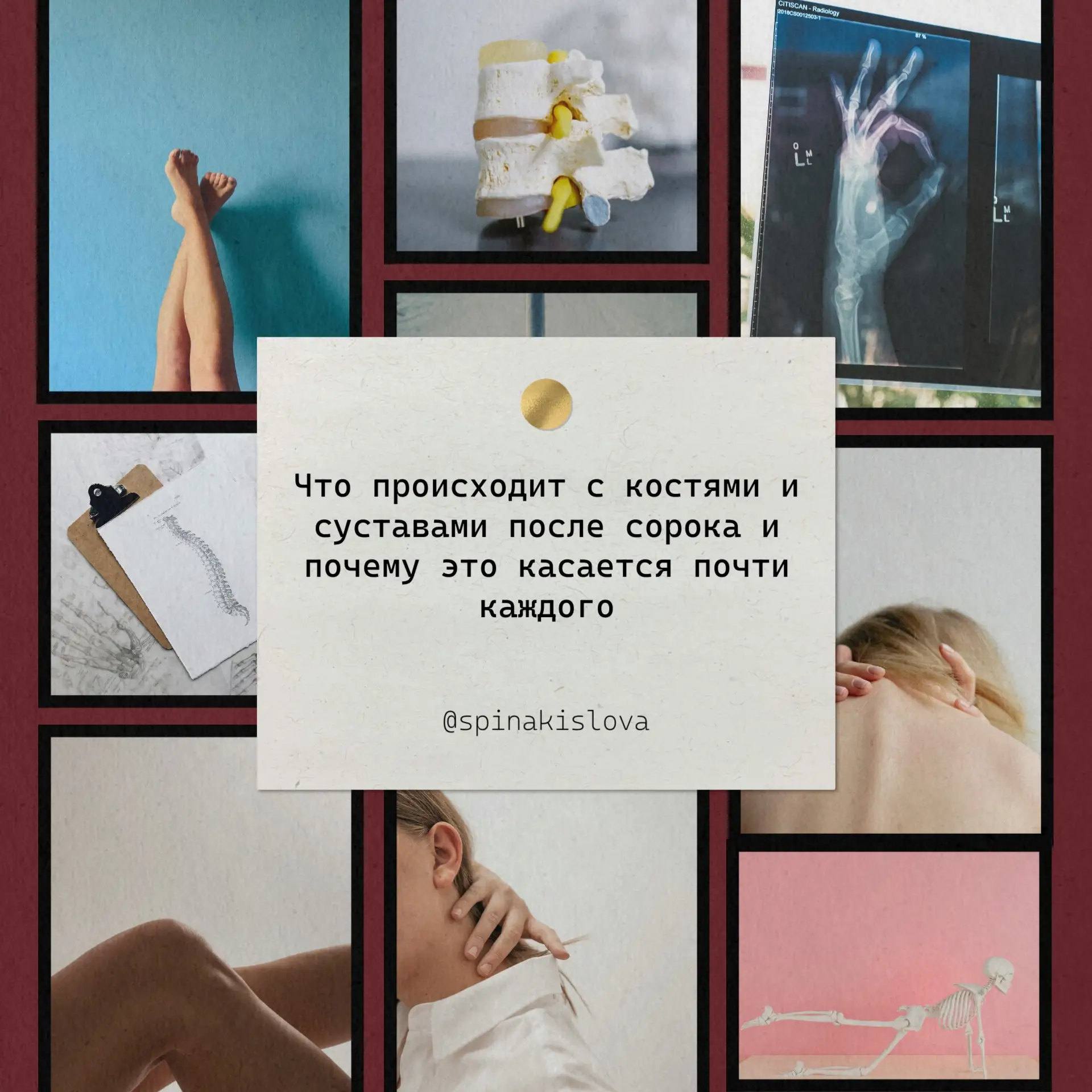 Что происходит с костями и суставами после сорока и почему это касается почти каждого