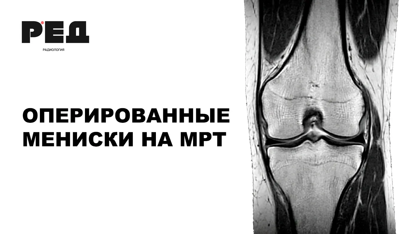 Тема, про которую почти не говорят, публикаций и видео в интернете не так уж и много!