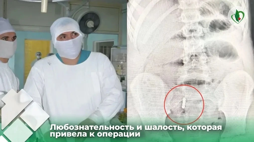 В хирургическое отделение  больницы поступил ребенок в тяжелом состоянии: сильные боли ...
