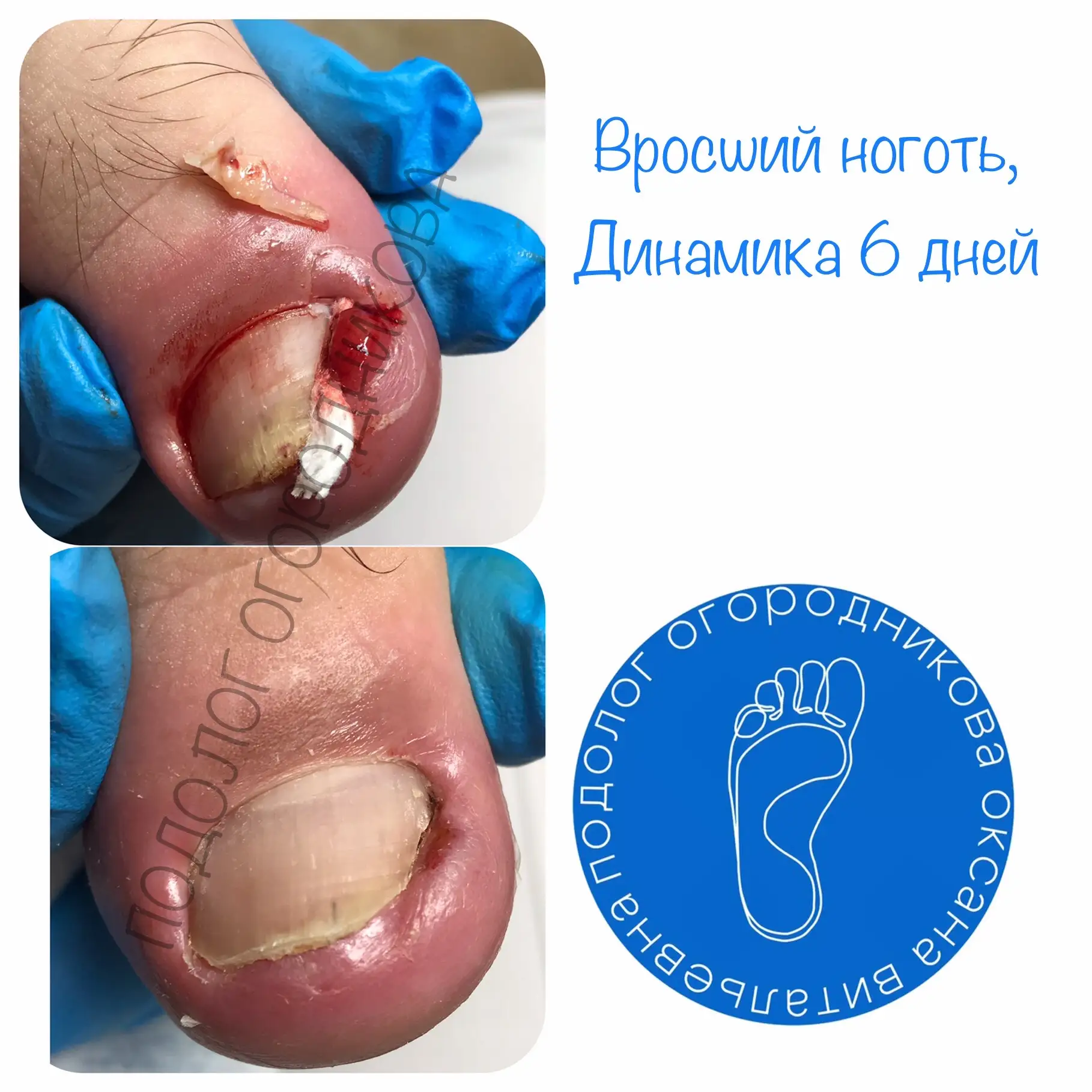 Как избежать подобных осложнений?