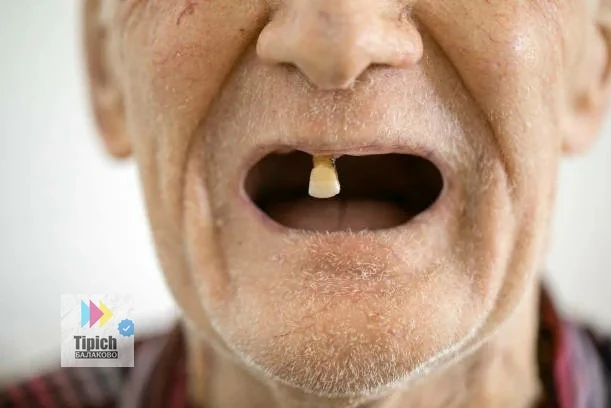 🦷 Без зубов и без помощи: как льготное протезирование обернулось бедой для ветерана Ба...