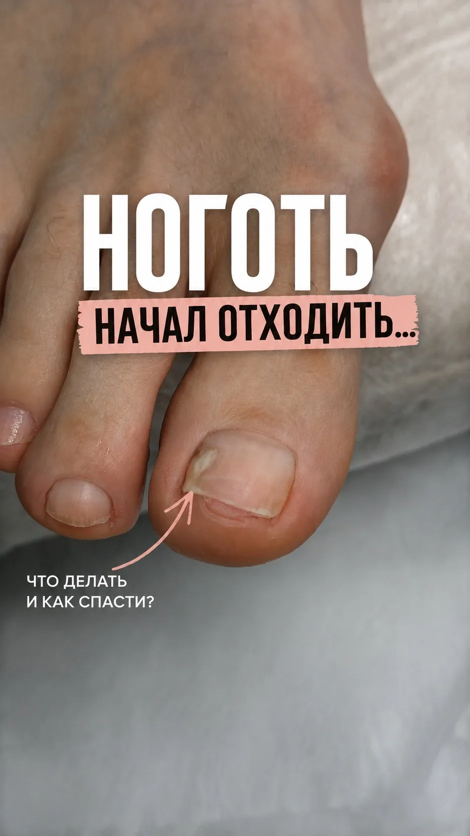 5 месяцев назад клиентка пришла с пустотой под ногтем.