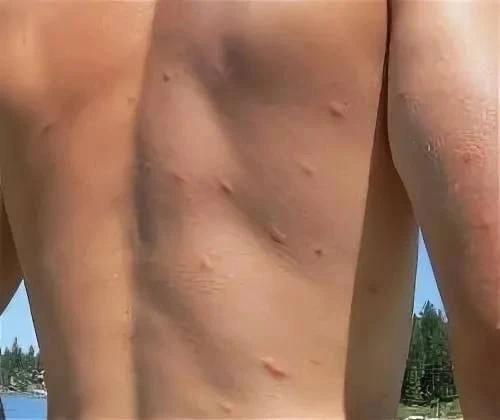 😱 После купания в Светлоярском озере сразу несколько отдыхающих столкнулись с неприятными последств