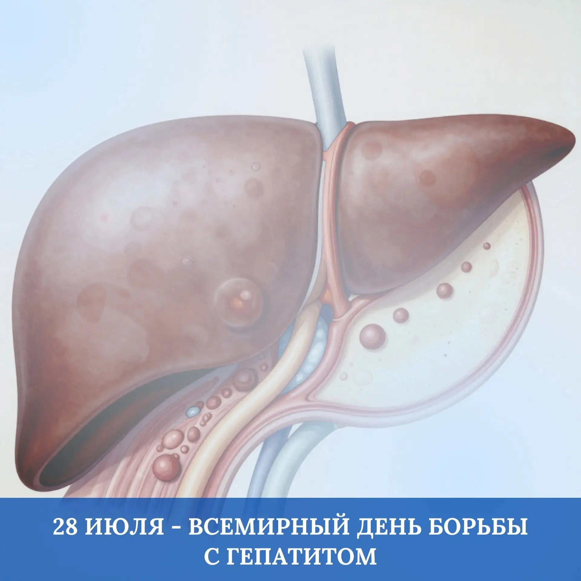 🗓28 июля отмечается Всемирный день борьбы с гепатитом

Гепатит - воспалительное заболевание печени,