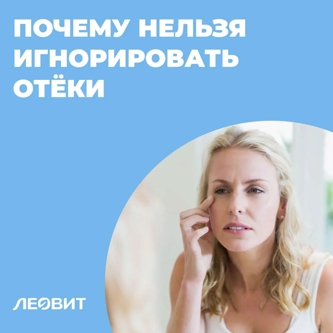 Отёки: сигнал проверить здоровье?

Многие считают отёки временной неприятностью и не обращают на них