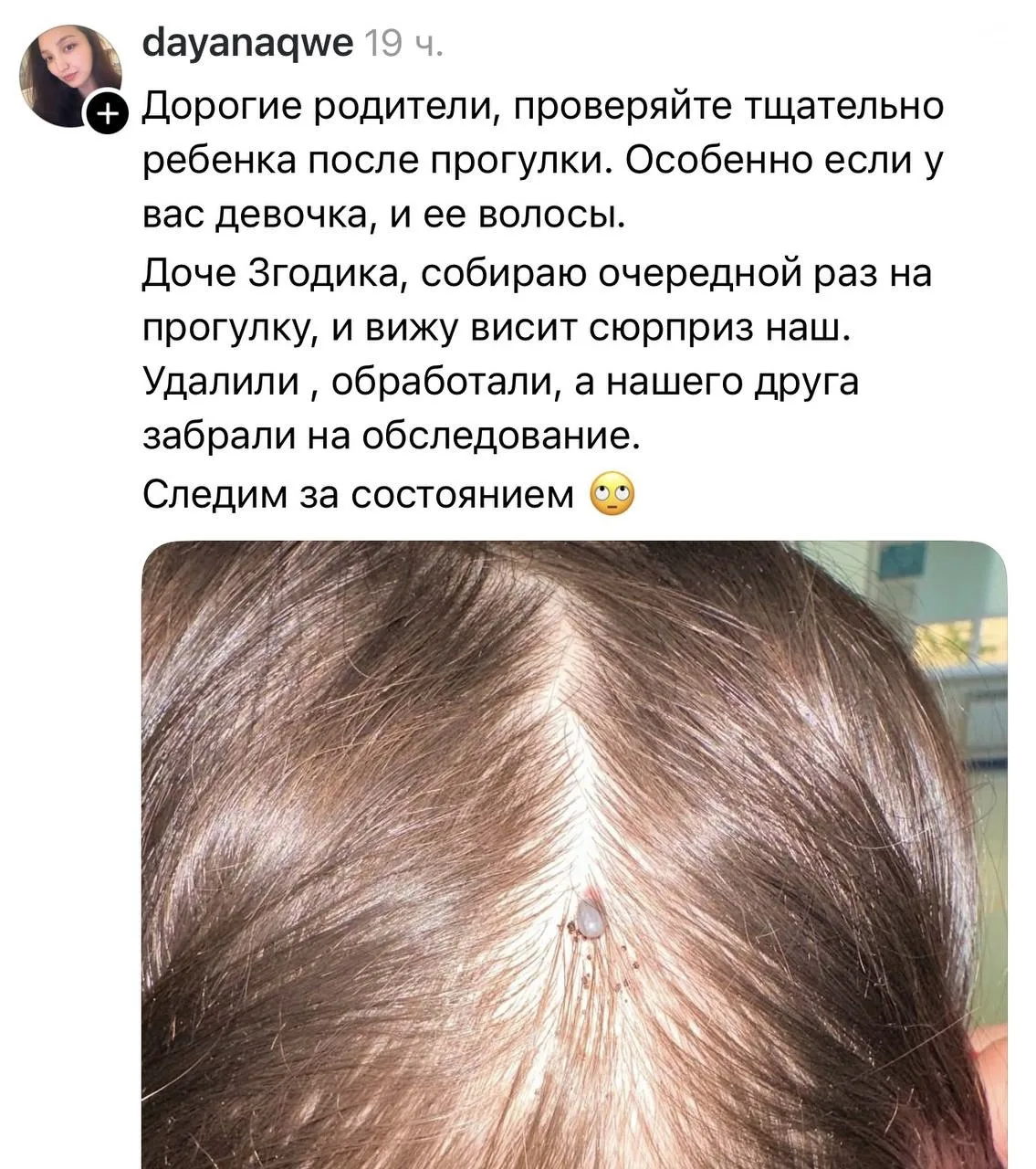 😳 Плюс ещё одна фобия