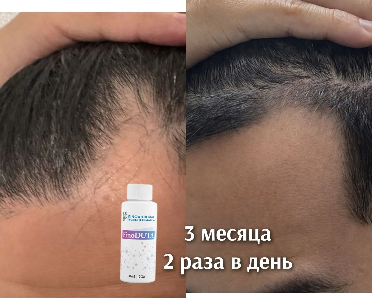 🌱Очень наглядная ситуация!