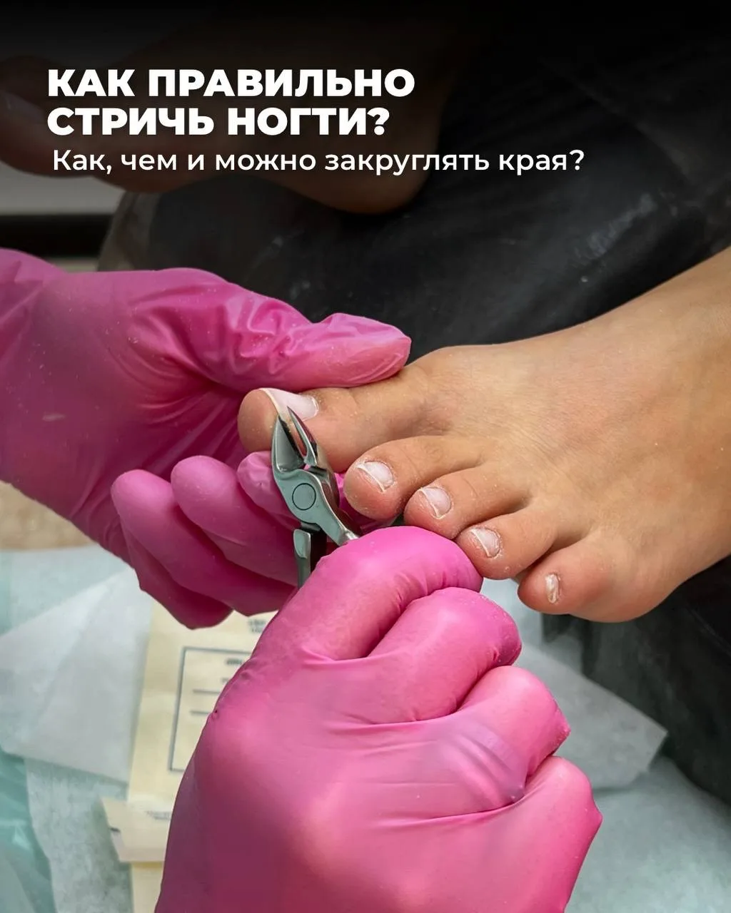 ❗️Стрижёте ногти неправильно и даже не подозреваете об этом

Вросшие ногти, боль при ходьбе, воспале