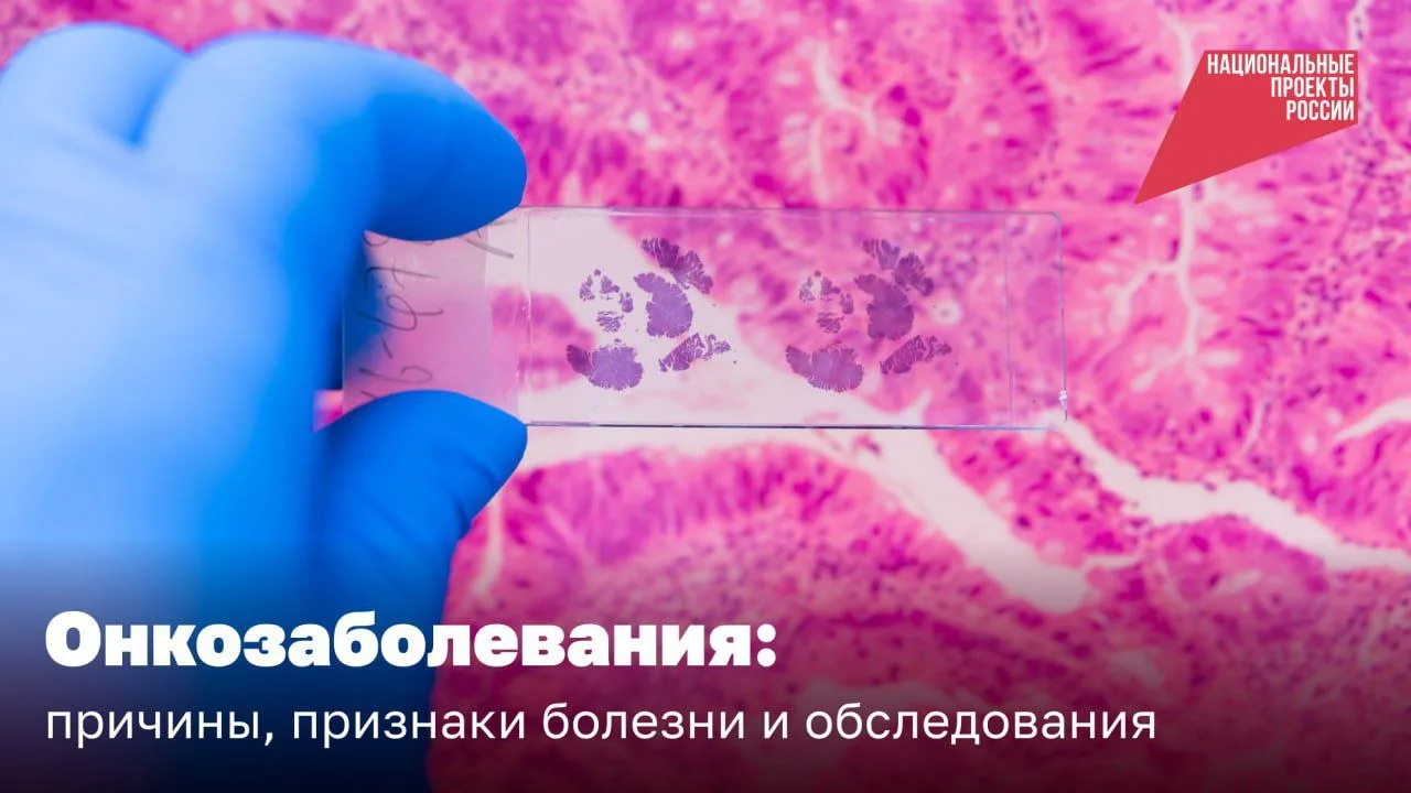 🏥 Борьба с онкологическими заболеваниями в рамках реализации национального проекта "Продолжительная
