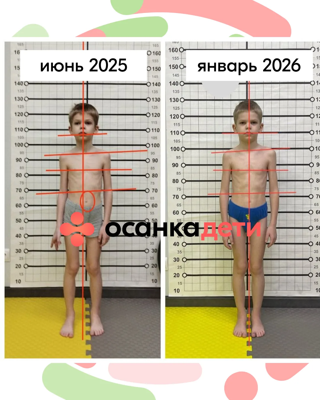 За полгода сын вырос на 8 см. Что спасло его осанку👇  Рассказываю на своем примере, почему период ак
