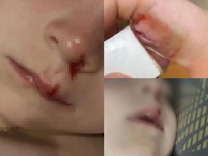 ⚠️ Жительница воронежского ЖК заявила о травмоопасной детской площадке.

Жительница микрорайона «Озе
