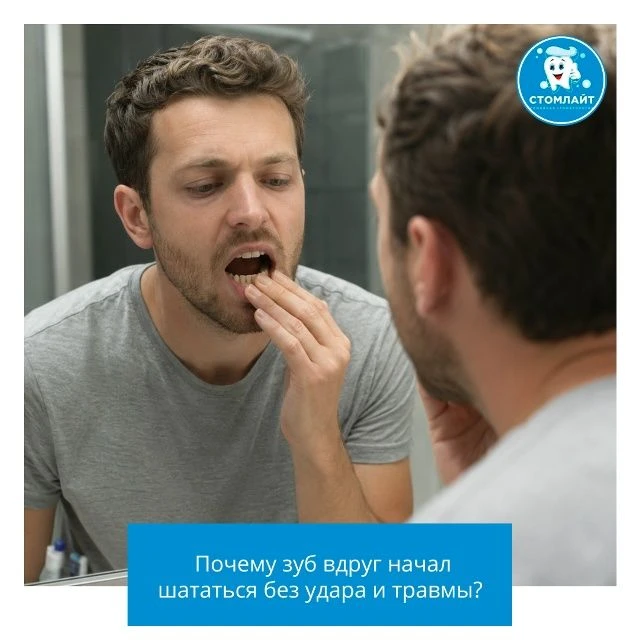 🔍 Почему зуб вдруг начал шататься без удара и травмы?