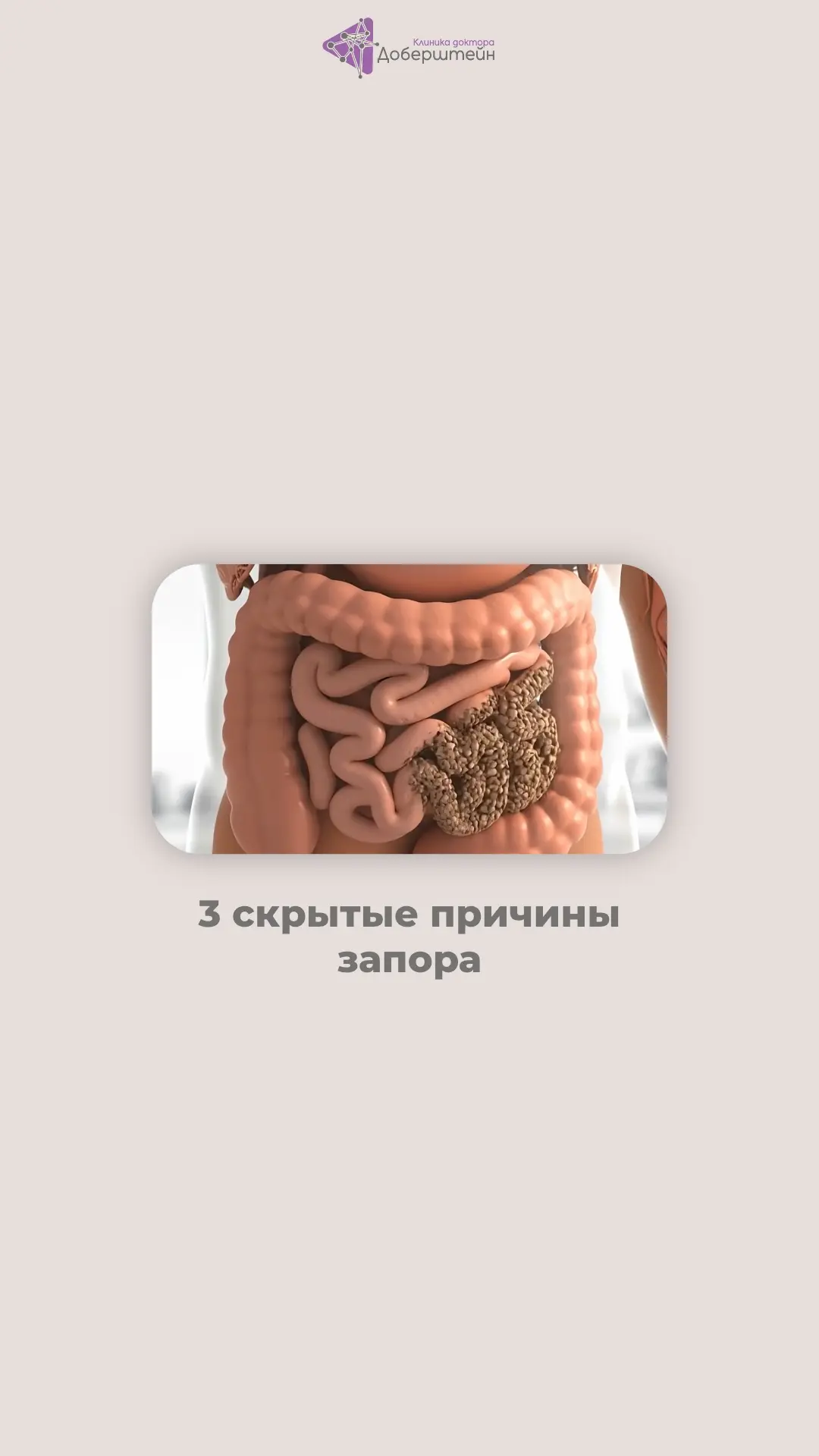 Почему у вас запоры, даже если вы пьёте достаточно воды?

На самом деле основных причин может быть н