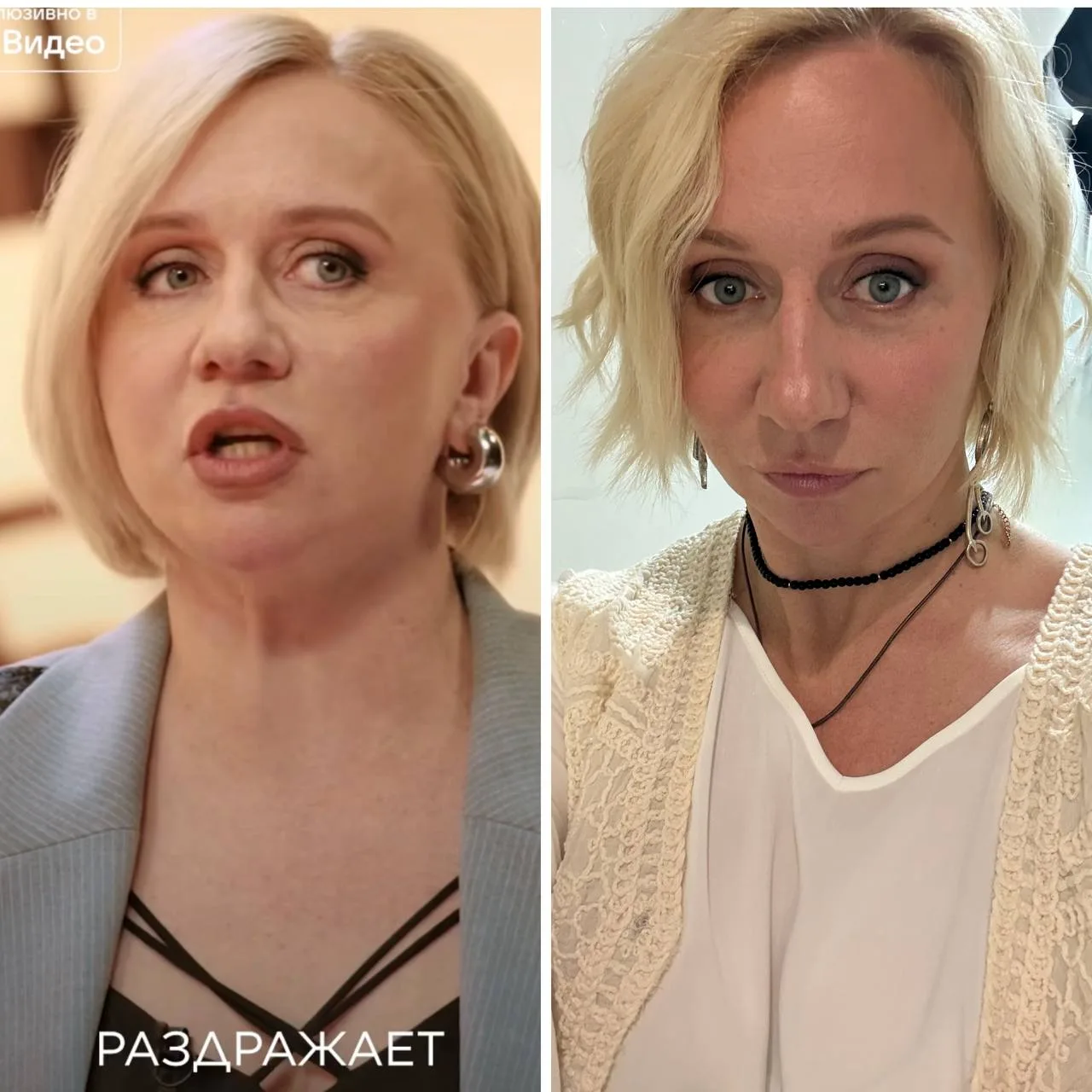 Как будто перепутала фото до и после.
