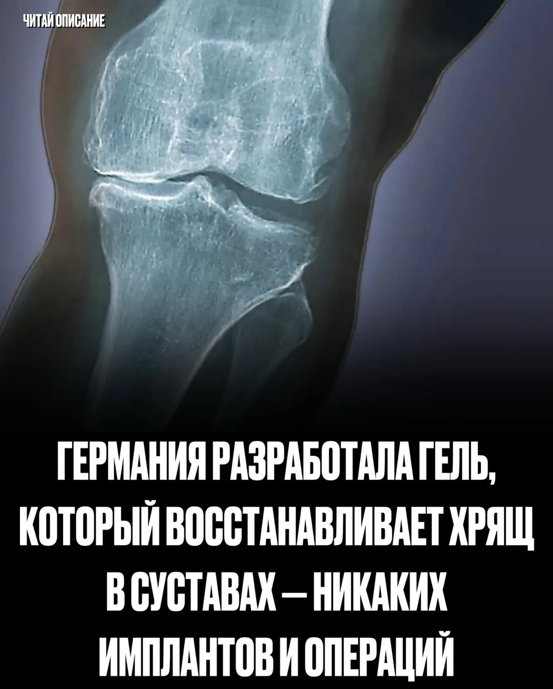 Вы бы попробовали эту новую терапию для восстановления суставов? 👇
Германия разработала революционн