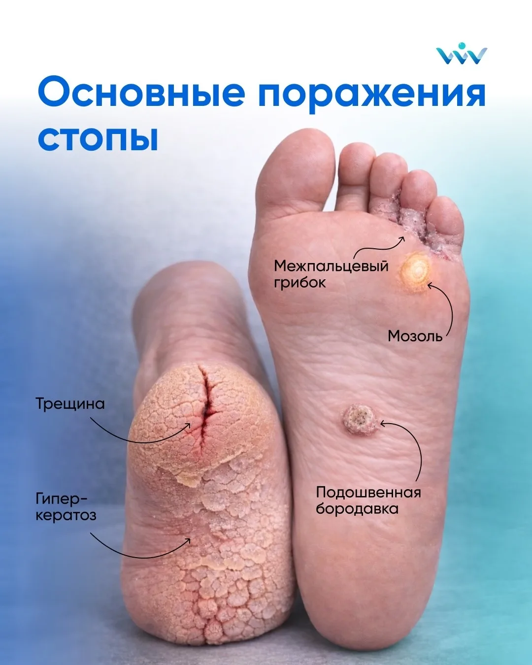 Ваши стопы заслуживают внимания! ☝🏼