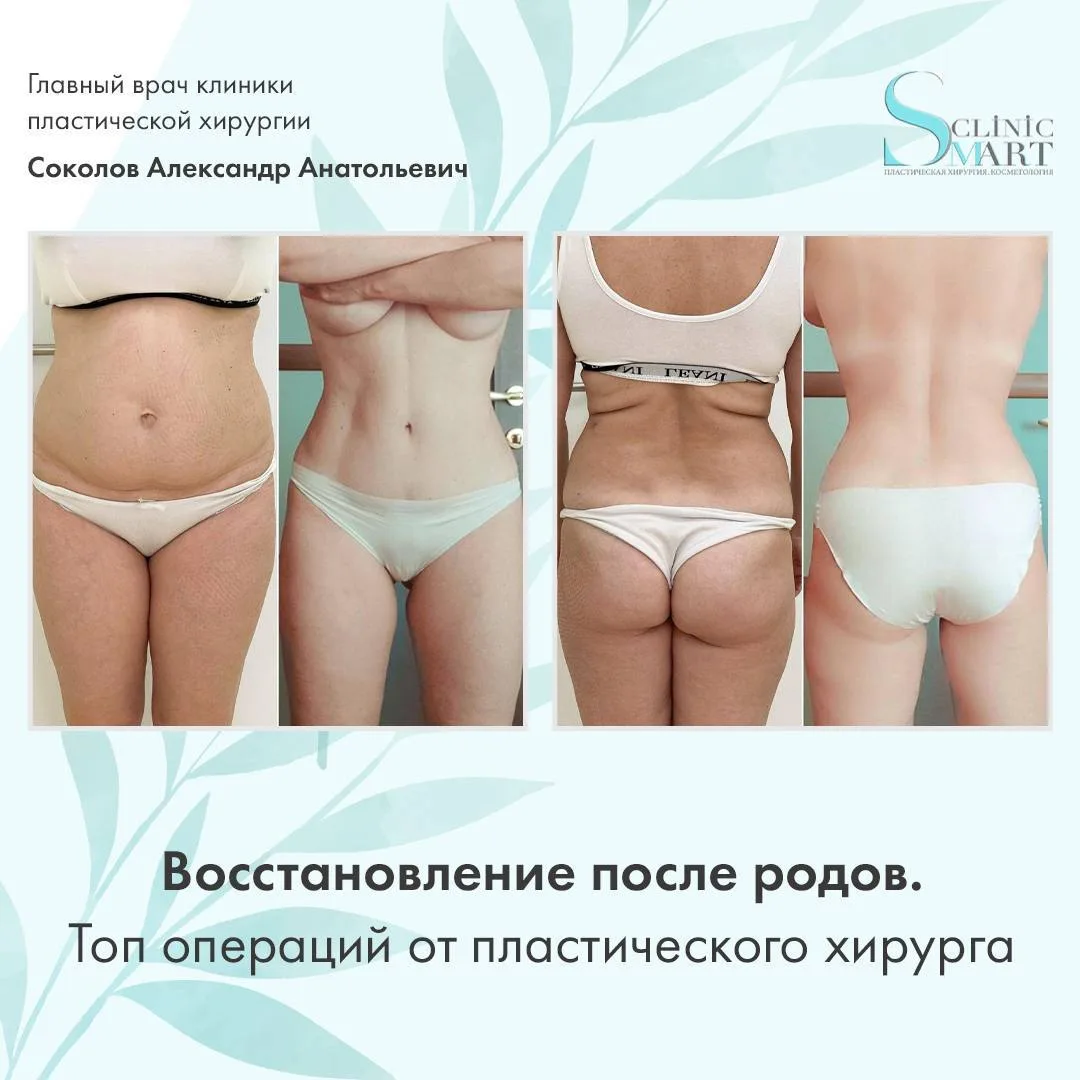 Изображение 1 к публикации «Маникюр Ногти»