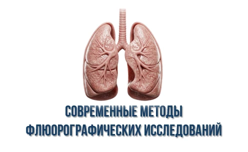 Современные методы флюорографических исследований: быстрее, безопаснее, точнее