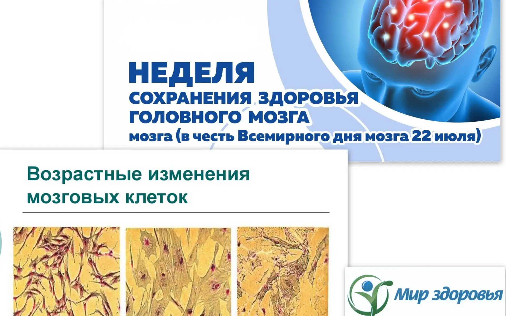 КОРОТКО О ВОЗРАСТНЫХ ИЗМЕНЕНИЯХ ЗДОРОВЬЯ ГОЛОВНОГО МОЗГА.
В рамках недели «Сохранения здоровья голов