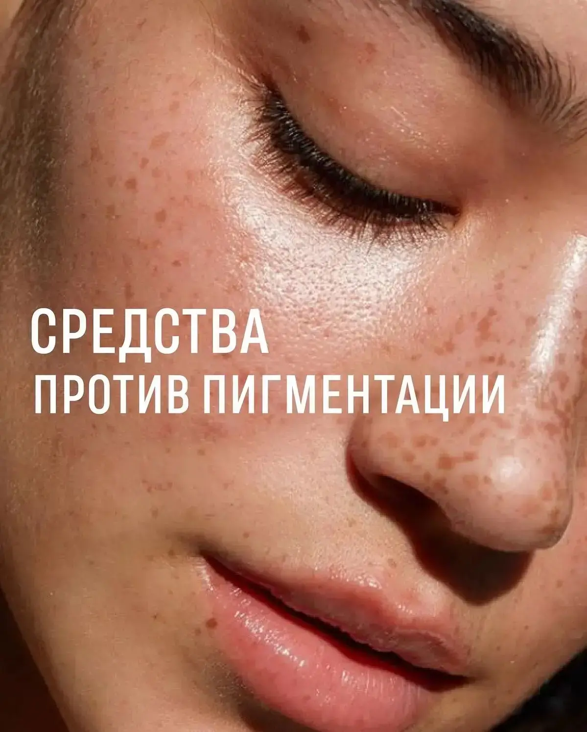 Какие средства помогают бороться с пигментацией?