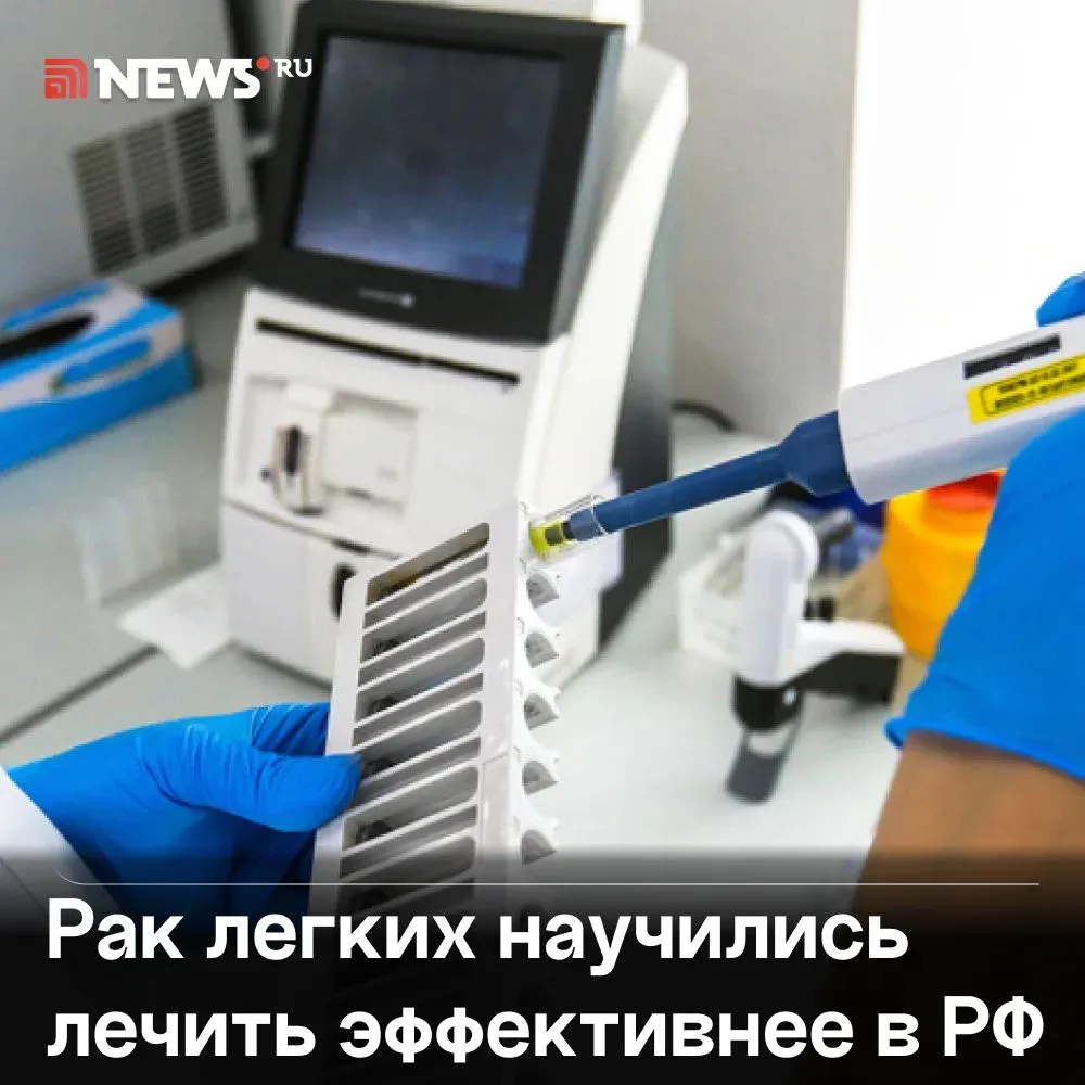 Препарат от диабета неожиданно помог в борьбе с одним из самых опасных видов рака легких.

Российски