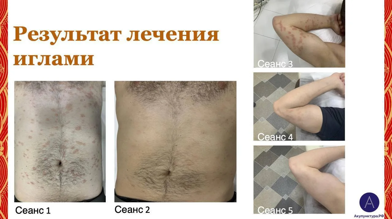 Клинический случай №3
