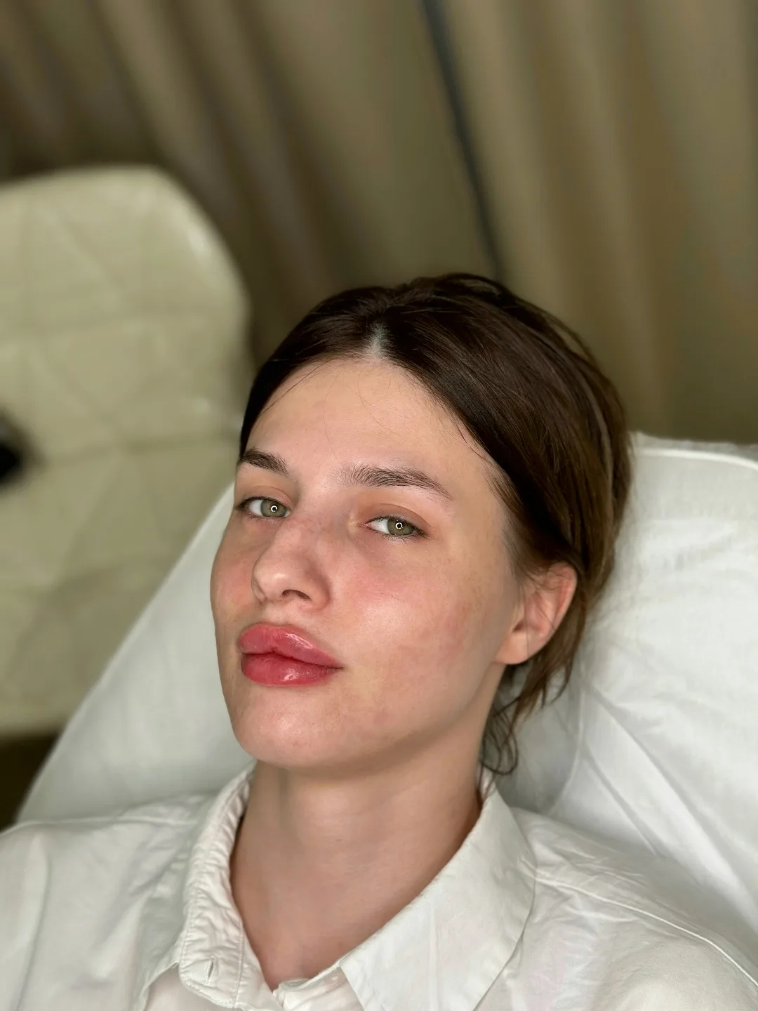 Нужны модели на увеличение губ, ботокс, био/мезо, неинвазивную карбокситерапию
Оплата только за преп