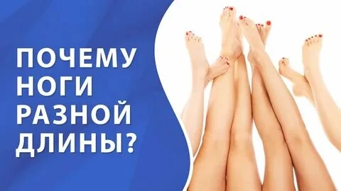 Разная длина ног — миф или реальность? Как плоская стопа перекашивает весь скелет