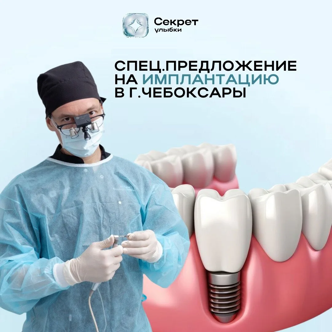 Только до 31.07. - имплант зуба от 24000₽ вместо 35 500₽